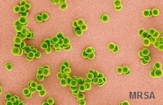 MRSA causes pandemics.